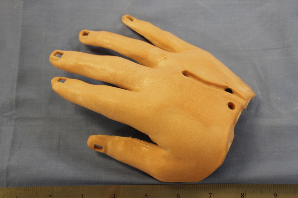 HAND, RIGHT DORSAL