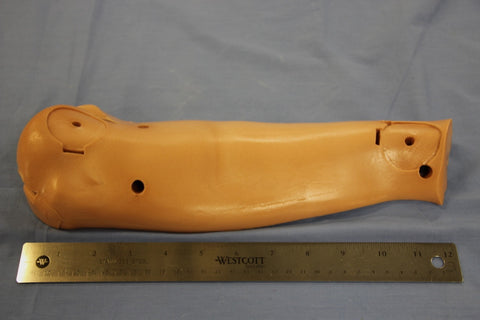 ARM, LOWER LEFT ANTERIOR
