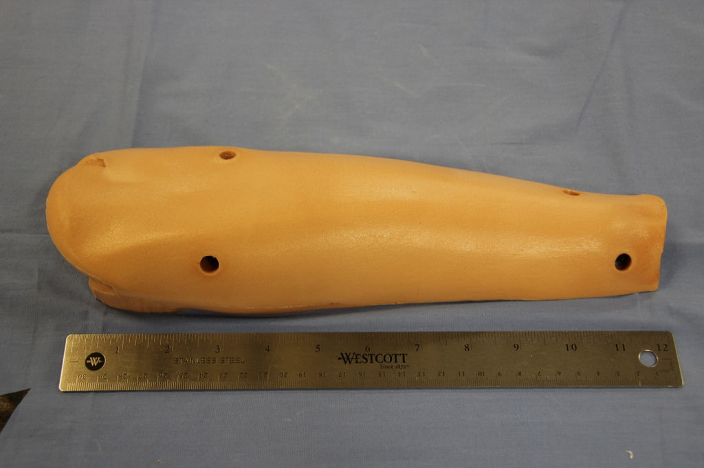 ARM, LOWER LEFT POSTERIOR