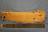 ARM, RIGHT LOWER ANTERIOR