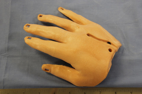 HAND, RIGHT DORSAL