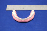 TEETH, UPPER