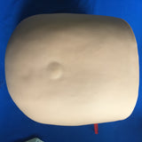 ASSY, ABDOMEN, INTRAPARTUM